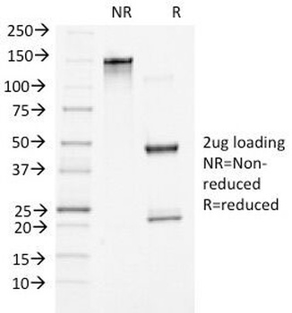 CTNNB1 Antibody