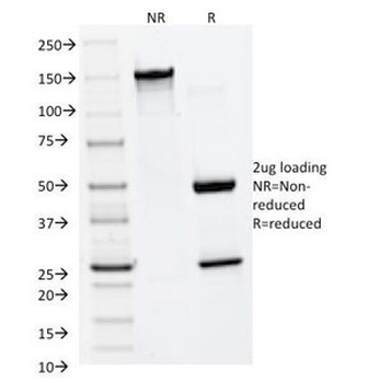 MMP2 Antibody