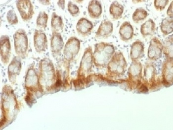 CTNNB1 Antibody