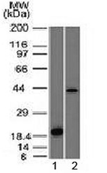 Aurora B Antibody [AURKB/1521]