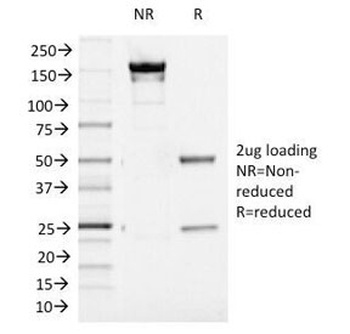 Aurora B Antibody [AURKB/1521]