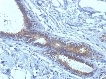 BRCA1 Antibody