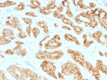 AMACR Antibody