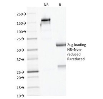 AMACR Antibody