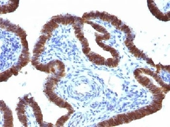 ASRGL1 Antibody [CRASH/1289]