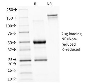 ASRGL1 Antibody