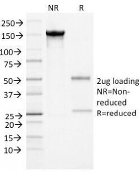 SERPINA3 Antibody