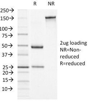 SERPINA3 Antibody