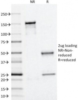 Adipophilin Antibody [ADFP/1366]