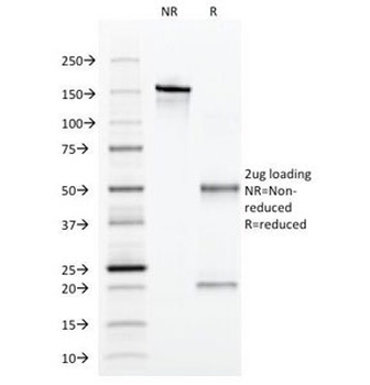 Alpha 1 Antitrypsin Antibody [AAT/1379]
