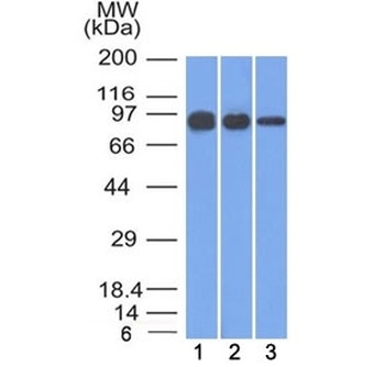 CTNNB1 Antibody