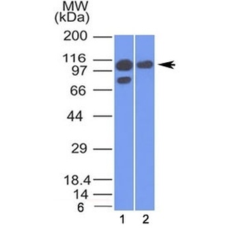 CTNNA1 Antibody