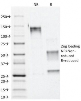 CTNNA1 Antibody