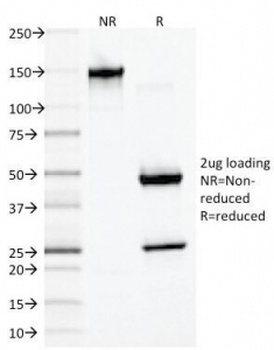 Desmin Antibody [DES/1711]