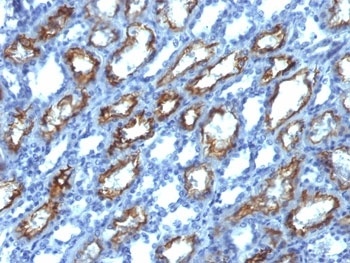 Interferon gamma Antibody [IFNG/466]