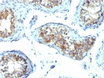 Interferon gamma Antibody [IFNG/466]