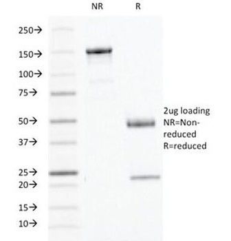 Interferon gamma Antibody [IFNG/466]