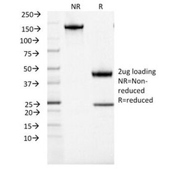 ACTH Antibody [CLIP/1407]