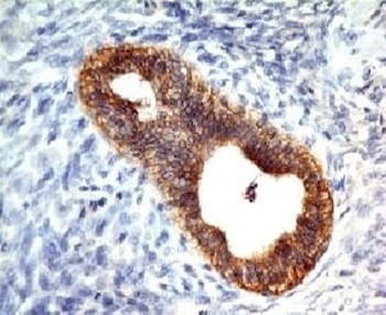 CDH1 Antibody