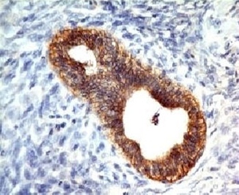 E-Cadherin Antibody [CDH1/1525]
