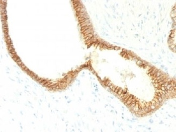 E-Cadherin Antibody [CDH1/1525]