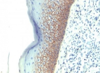 CDH1 Antibody