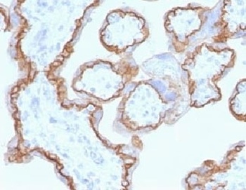 CDH1 Antibody