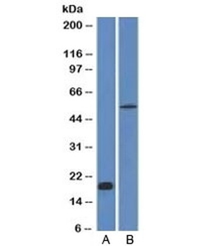 CDH1 Antibody