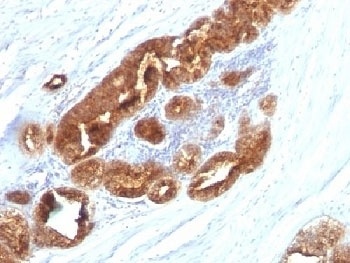 TAG-72 Antibody [CC49]