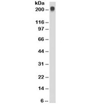TAG-72 Antibody [CC49]