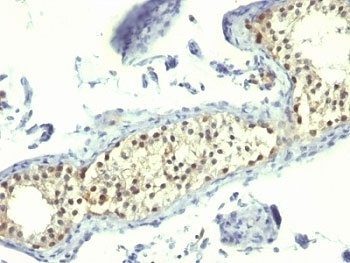 TYMS Antibody