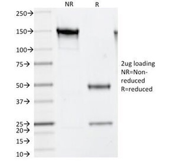 TYMS Antibody