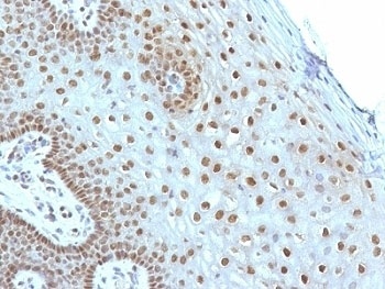 MYC Antibody