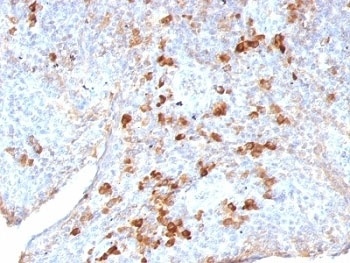 IGLV1-51 Antibody