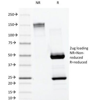 IGLV1-51 Antibody