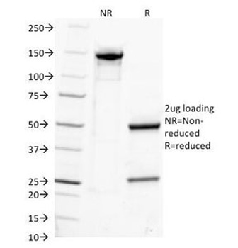 IGHG1, IGHG2, IGHG3, IGHG4 Antibody