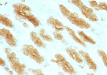 KRT76 Antibody