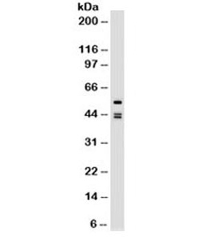 KRT8, KRT18 Antibody