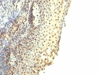 IPO-38 Antibody [IPO-38]