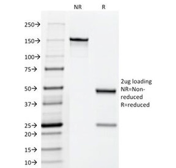 CGA Antibody