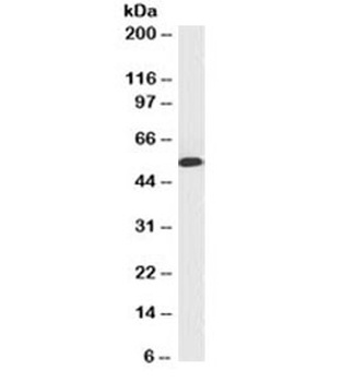 Cytokeratin 10 + 13 Antibody [SPM262]