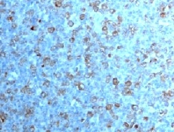 CDK1 Antibody