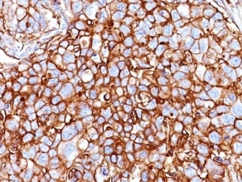 CD44 Antibody