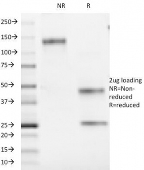 CD1a Antibody [66IIC7]