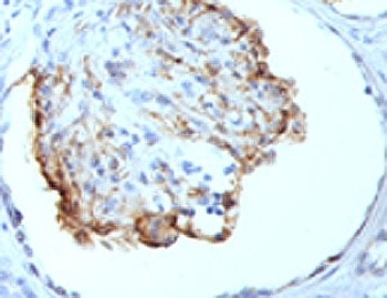 WT1 Antibody