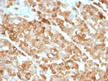 Tyrosinase Antibody [OCA1/812]