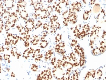 TLR2 Antibody [TLR2/221]