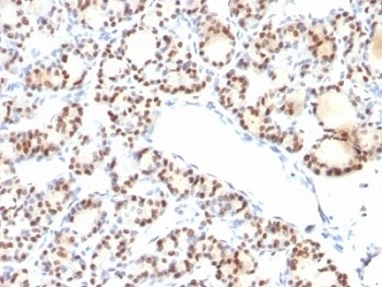 NKX2-1 Antibody