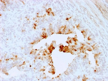 TGFB1, TGFB3, TGFB2 Antibody