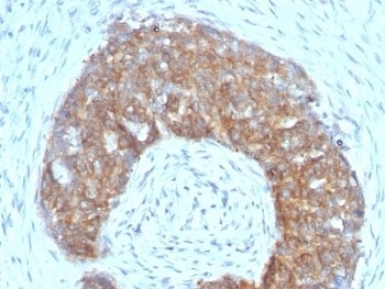 TFF1 Antibody
